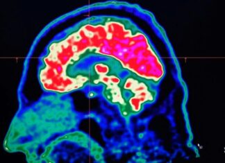 O mundo está ficando mais quente e isso está afetando nossos cérebros