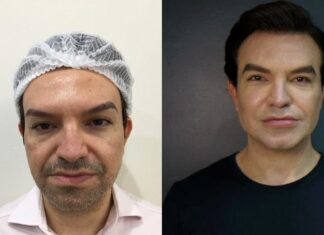 Ken Humano de SP faz rejuvenescimento anal: ‘não me arrependo’